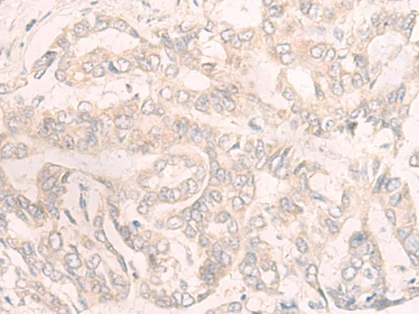 ENOSF1 Rabbit Polyclonal Antibody - image 1