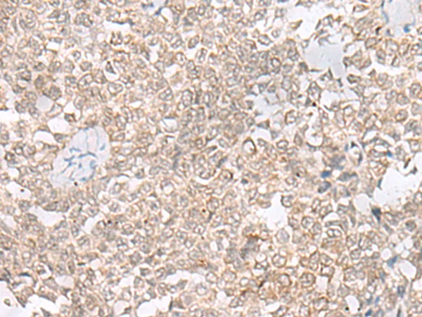 EHMT2/G9A (EHMT2) Rabbit Polyclonal Antibody - image 1