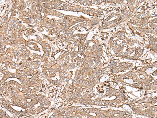 FAAP24 Rabbit Polyclonal Antibody - image 1