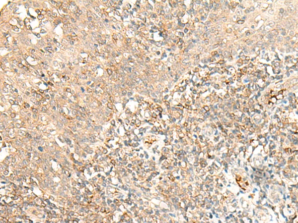 MOBKL2B (MOB3B) Rabbit Polyclonal Antibody - image 1