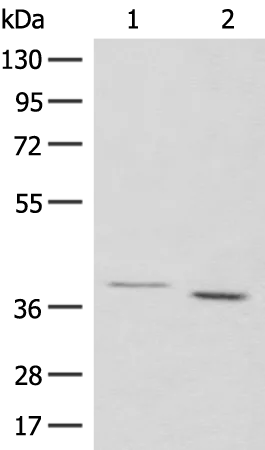 GALR1 Rabbit Polyclonal Antibody - image 1
