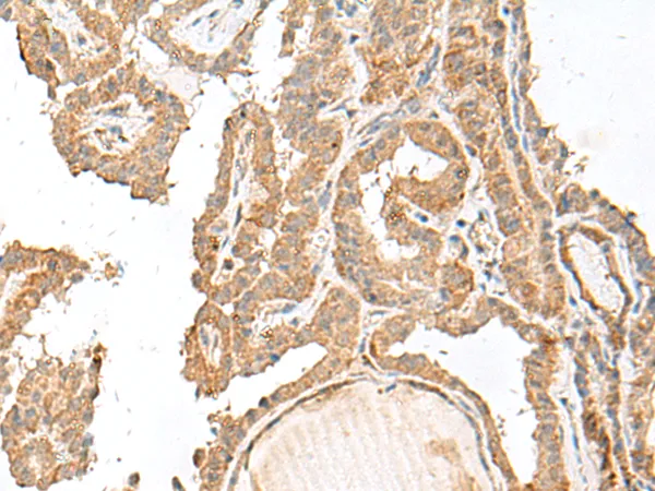 GART Rabbit Polyclonal Antibody - image 1