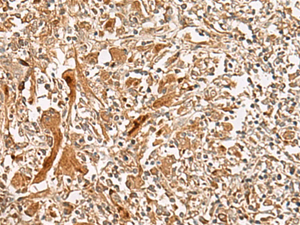 GCC2 Rabbit Polyclonal Antibody - image 1
