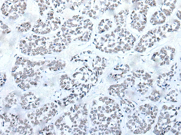 BRD3 Rabbit Polyclonal Antibody - image 1