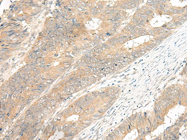 GPR12 Rabbit Polyclonal Antibody - image 1