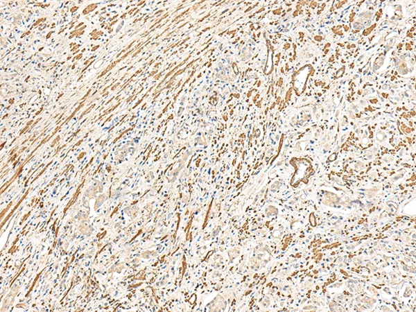 GPCR TGR7 (MRGPRD) Rabbit Polyclonal Antibody - image 1