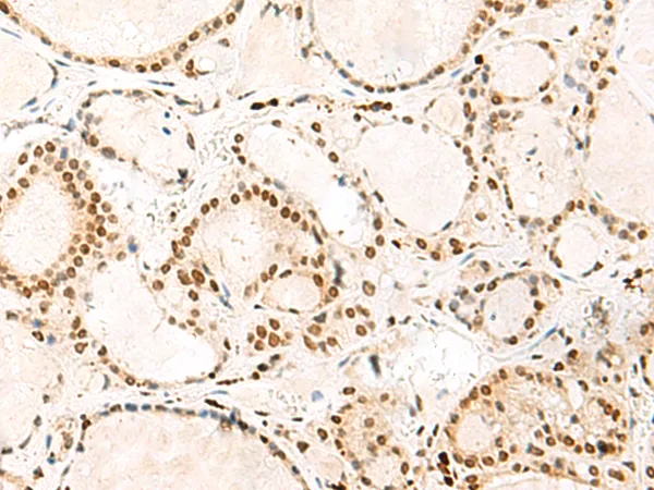 HNRPA3 (HNRNPA3) Rabbit Polyclonal Antibody - image 1