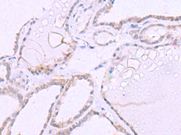 Integrin beta 7 (ITGB7) Rabbit Polyclonal Antibody - image 1