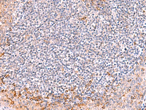 Intersectin 2 (ITSN2) Rabbit Polyclonal Antibody - image 1