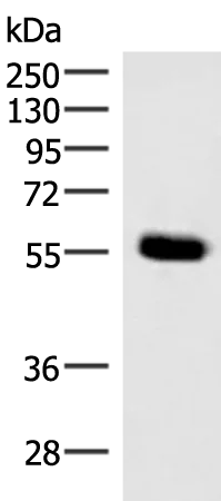 IPPK Rabbit Polyclonal Antibody - image 1