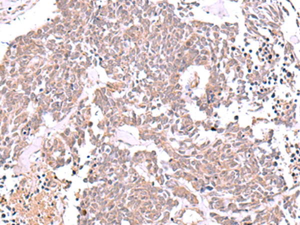JDP2 Rabbit Polyclonal Antibody - image 1