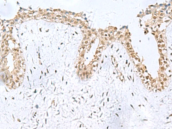 KDM2B Rabbit Polyclonal Antibody - image 1