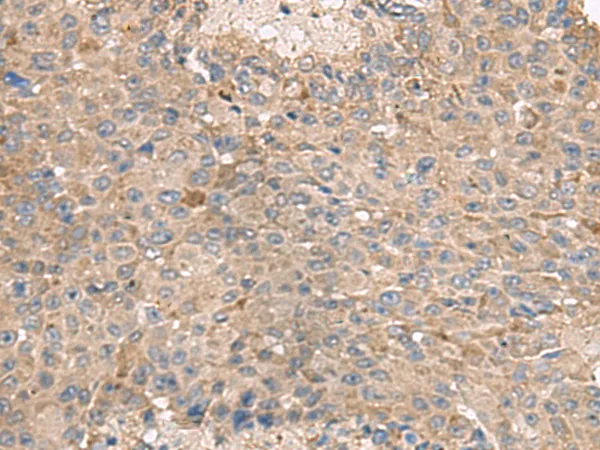 ABCA10 Rabbit Polyclonal Antibody - image 1