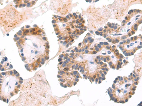 ARRDC4 Rabbit Polyclonal Antibody - image 1