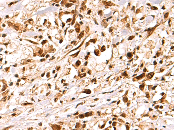 MTA1 Rabbit Polyclonal Antibody - image 1