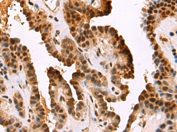DNMT3B Rabbit Polyclonal Antibody - image 1
