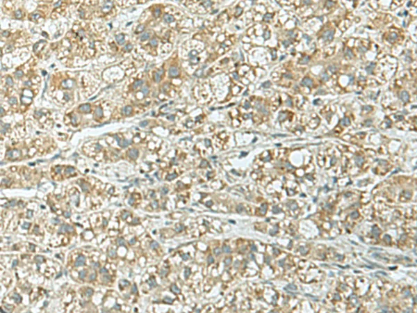 RAP1GAP Rabbit Polyclonal Antibody - image 1