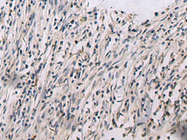 CNTF Rabbit Polyclonal Antibody - image 1