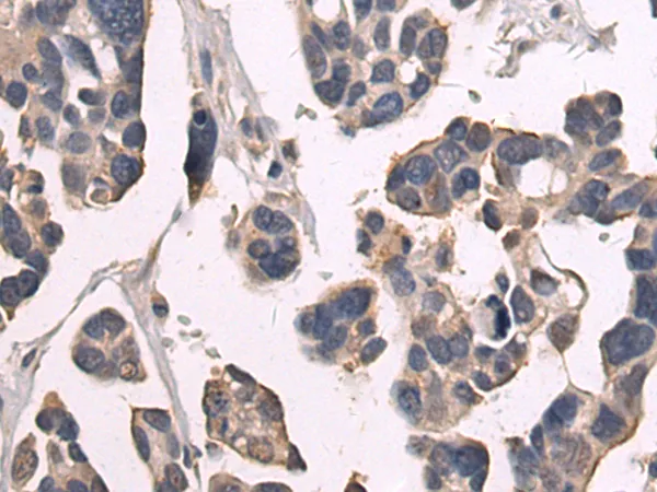 SREBP1 (SREBF1) Rabbit Polyclonal Antibody - image 1