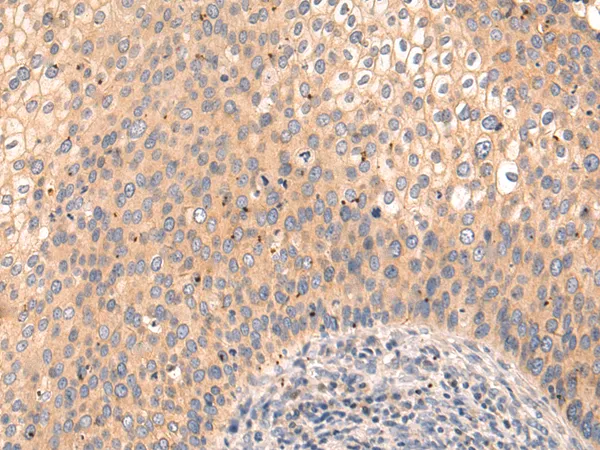 PI 3 Kinase catalytic subunit alpha (PIK3CA) Rabbit Polyclonal Antibody - image 1