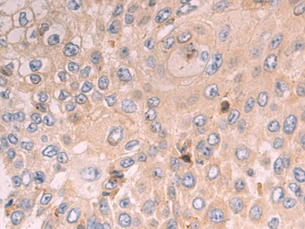 SLC25A39 Rabbit Polyclonal Antibody - image 1
