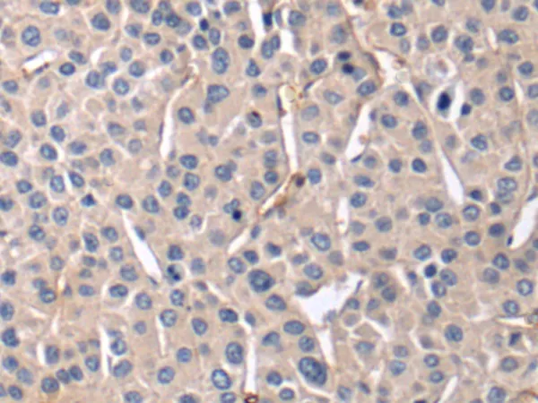 c Abl (ABL1) Rabbit Polyclonal Antibody - image 1