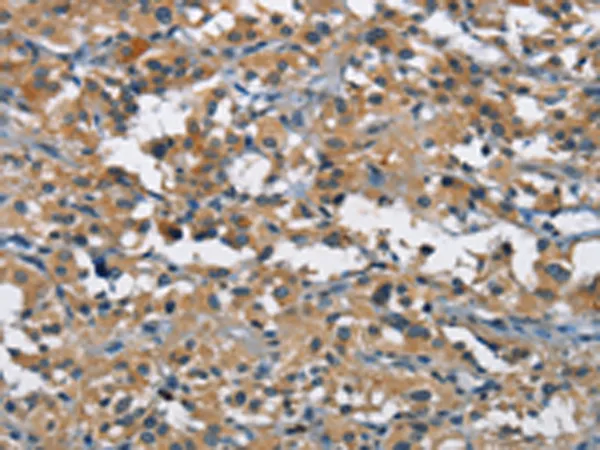 BMPR1B Rabbit Polyclonal Antibody - image 1