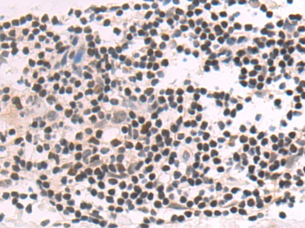 CDC25A Rabbit Polyclonal Antibody - image 1