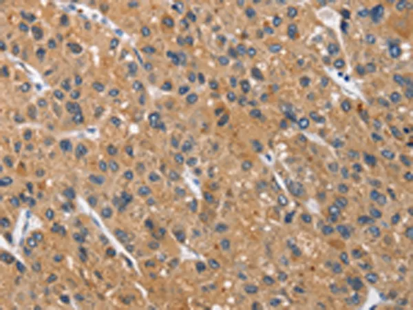CEACAM3 Rabbit Polyclonal Antibody - image 1