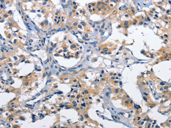 CLEC2D Rabbit Polyclonal Antibody - image 1
