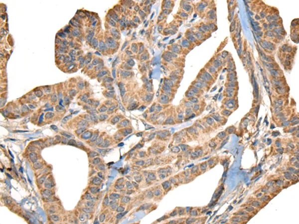 SLAMF7 Rabbit Polyclonal Antibody - image 1