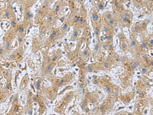 DTX2 Rabbit Polyclonal Antibody - image 1
