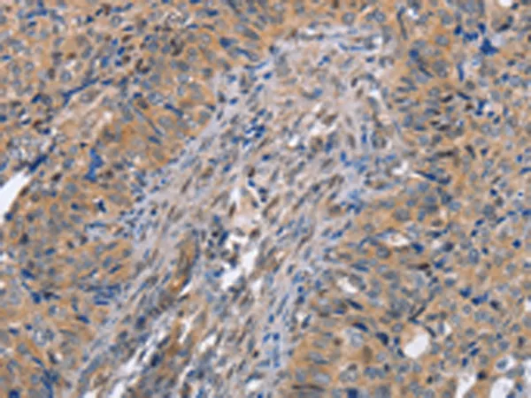 MEK1 (MAP2K1) Rabbit Polyclonal Antibody - image 1