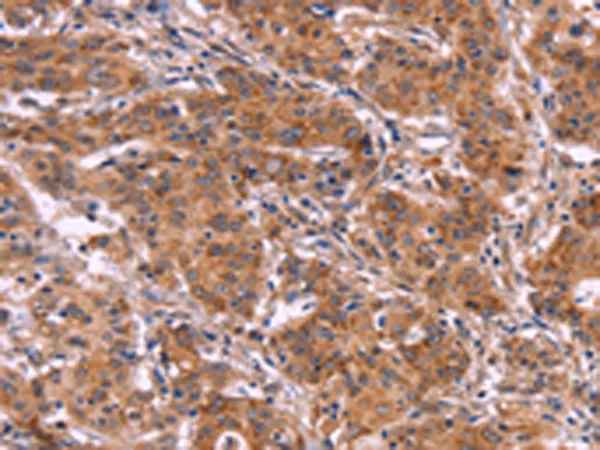 MMP14 Rabbit Polyclonal Antibody - image 1