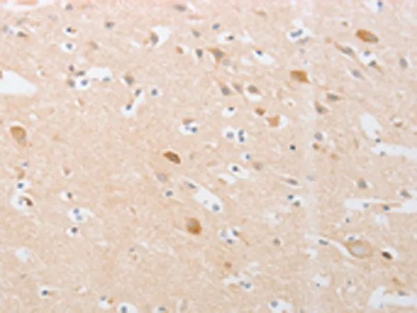 CDKN2AIP Rabbit Polyclonal Antibody - image 1