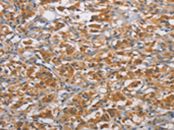 RICTOR Rabbit Polyclonal Antibody - image 1