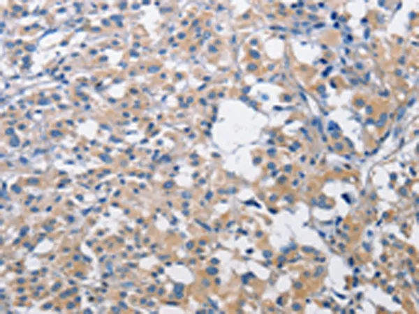 PIM2 Rabbit Polyclonal Antibody - image 1