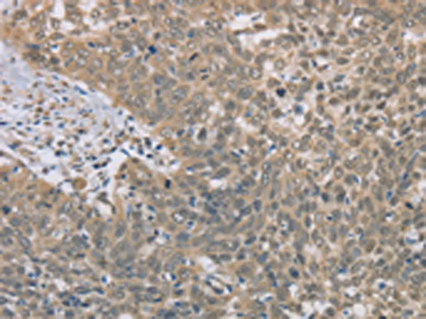 DACH2 Rabbit Polyclonal Antibody - image 1