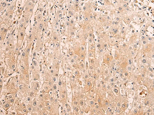 Semaphorin 3c (SEMA3C) Rabbit Polyclonal Antibody - image 1