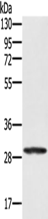 EDA2R Rabbit Polyclonal Antibody - image 1