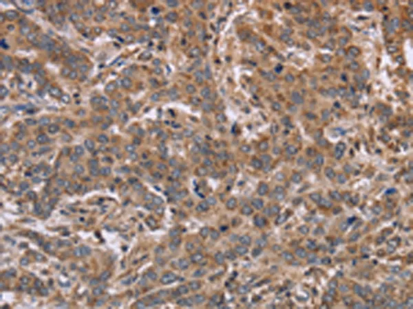 FAAH2 Rabbit Polyclonal Antibody - image 1