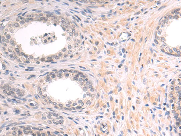 GCDFP 15 (PIP) Rabbit Polyclonal Antibody - image 1