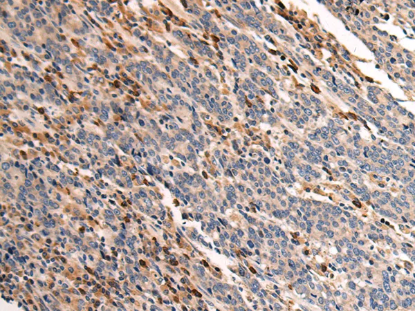 MAP3K9 Rabbit Polyclonal Antibody - image 1
