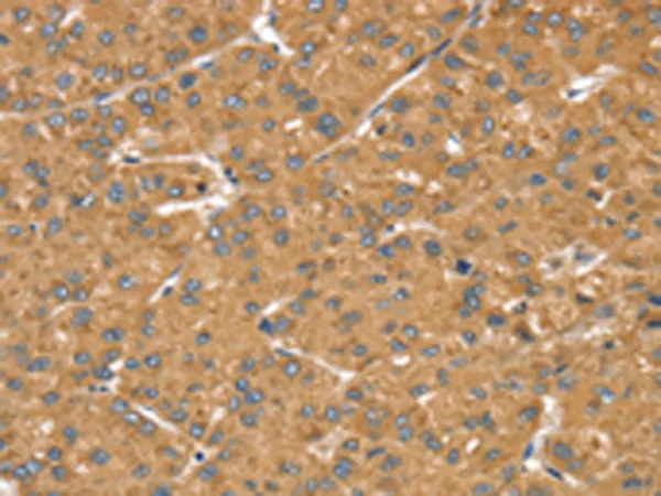 LMO4 Rabbit Polyclonal Antibody - image 1