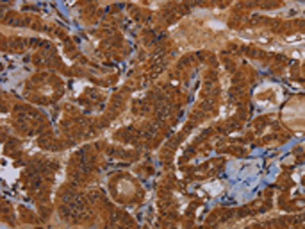Morg1 (WDR83) Rabbit Polyclonal Antibody - image 1