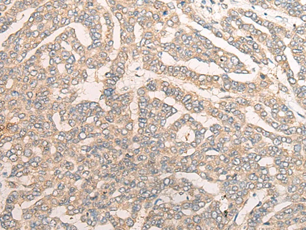 TRAF4 Rabbit Polyclonal Antibody - image 1