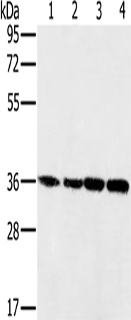 MRPL39 Rabbit Polyclonal Antibody - image 1