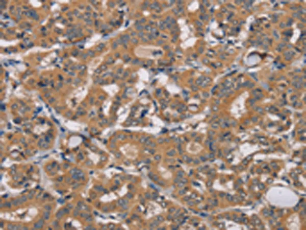 TRAFD1 Rabbit Polyclonal Antibody - image 1