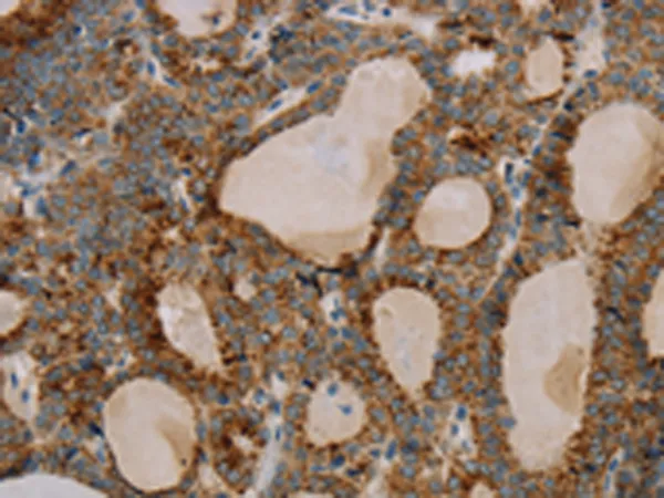 PARL Rabbit Polyclonal Antibody - image 1