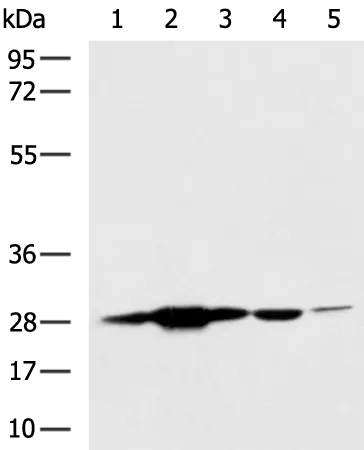 PGAM2 Rabbit Polyclonal Antibody - image 1